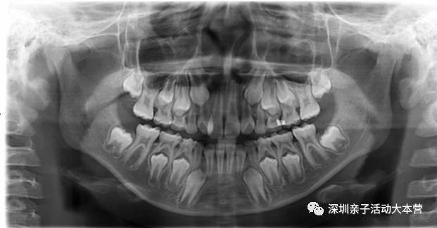 南山丨8月小牙医场次终于谈下来了,新增6-12岁换牙期孩子专场